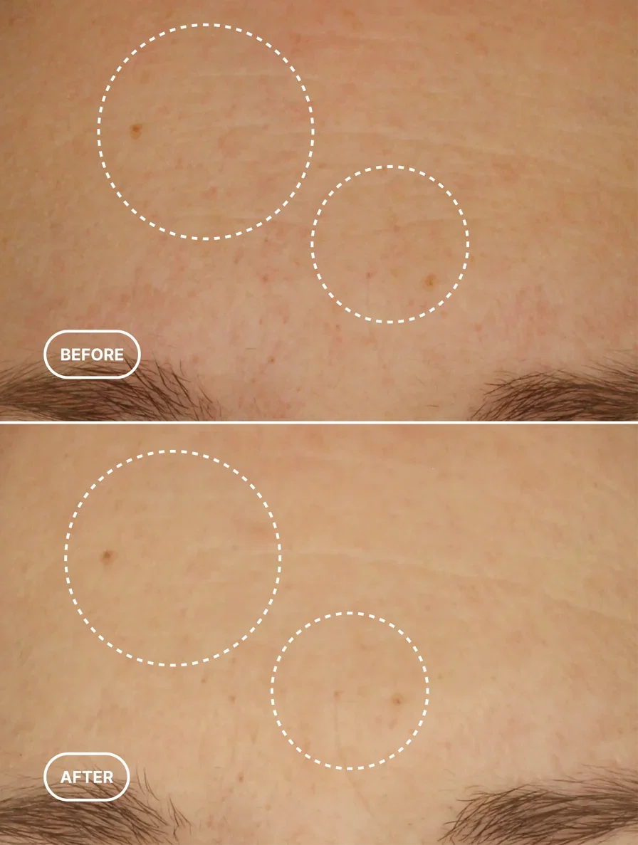 Retinol Alternative Serum